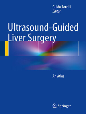 cover image of Ultrasound-Guided Liver Surgery